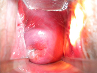 Illustration for article titled Why the Cervix Is More Amazing Than You Realized